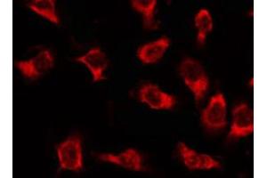 ABIN6269341 staining 293 by IF/ICC.