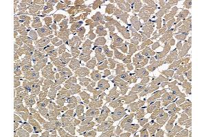 ABIN7097103 and ABIN7101170 at 1/100 staining rat heart tissue by IHC-P. (Dolichol Kinase anticorps)
