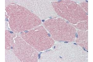 Human Skeletal Muscle: Formalin-Fixed, Paraffin-Embedded (FFPE) (STK39 anticorps  (C-Term))