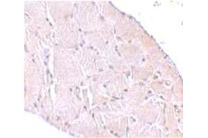 Immunohistochemical staining of human skeletal muscle tissue with 10 ug/mL WNT10A polyclonal antibody . (WNT10A anticorps  (C-Term))