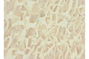 Immunohistochemistry of paraffin-embedded human heart tissue using ABIN7149412 at dilution of 1:100