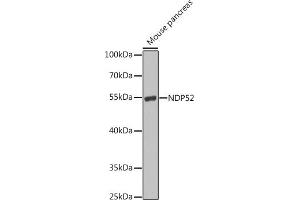 Western blot analysis of extracts of mouse pancreas, using NDP52 antibody (ABIN6131368, ABIN6137860, ABIN6137861 and ABIN6223210) at 1:1000 dilution. (CALCOCO2 anticorps  (AA 137-446))