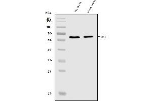 Western blot analysis of ZIC3 using anti-ZIC3 antibody (ABIN7599755).