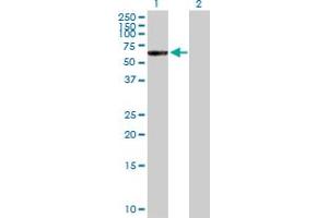 Western Blot analysis of CTNNA3 expression in transfected 293T cell line by CTNNA3 MaxPab polyclonal antibody. (CTNNA3 anticorps  (AA 1-516))