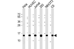 All lanes : Anti-Profilin-1 Antibody at 1:2000 dilution Lane 1: Hela whole cell lysate Lane 2: HUVEC whole cell lysate Lane 3: Jurkat whole cell lysate Lane 4: 293 whole cell lysate Lane 5: NIH/3T3 whole cell lysate Lane 6: C6 whole cell lysate Lysates/proteins at 20 μg per lane. (PFN1 anticorps  (AA 108-140))
