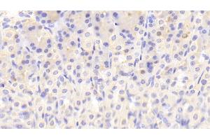 Detection of NT in Mouse Stomach Tissue using Polyclonal Antibody to Neurotensin (NT)