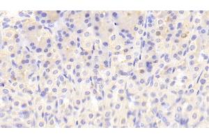 Detection of NT in Mouse Stomach Tissue using Polyclonal Antibody to Neurotensin (NT) (Neurotensin anticorps  (AA 42-167))