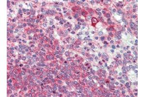 Human Spleen (formalin-fixed, paraffin-embedded) stained with LXNfollowed by biotinylated goat anti-rabbit IgG secondary antibody, alkaline phosphatase-streptavidin and chromogen. (Latexin anticorps  (Center))