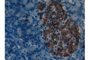 IHC-P analysis of Mouse Pancreas Tissue, with DAB staining. (PNPLA2 anticorps  (AA 481-702))