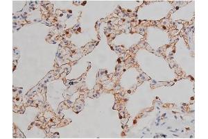 ABIN6267331 at 1/200 staining Rat lung tissue sections by IHC-P.