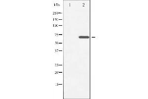 Western blot analysis of ZAP-70 phosphorylation expression in Jurkat whole cell lysates,The lane on the left is treated with the antigen-specific peptide. (ZAP70 anticorps  (pTyr493))