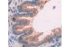 IHC-P analysis of Rat Tissue, with DAB staining. (CXCL11 anticorps  (AA 22-100))