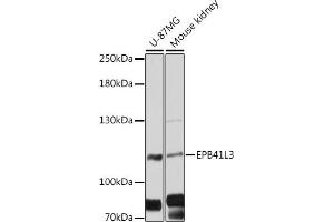 Western blot analysis of extracts of various cell lines, using EPB41L3 antibody (ABIN6127807, ABIN6140201, ABIN6140202 and ABIN6216501) at 1:3000 dilution.