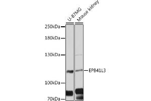 Western blot analysis of extracts of various cell lines, using EPB41L3 antibody (ABIN6127807, ABIN6140201, ABIN6140202 and ABIN6216501) at 1:3000 dilution. (EPB41L3 anticorps  (AA 656-865))