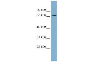 WB Suggested Anti-CACNB2 Antibody Titration:  0. (CACNB2 anticorps  (Middle Region))