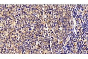 Detection of S100A8 in Porcine Lymph node Tissue using Polyclonal Antibody to S100 Calcium Binding Protein A8 (S100A8) (S100A8 anticorps  (AA 1-89))