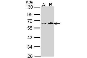 WB Image Sample (30 ug of whole cell lysate) A: H1299 B: Hela 10% SDS PAGE antibody diluted at 1:1000 (Fukutin anticorps)