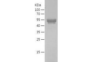 Western Blotting (WB) image for Cardiac Troponin T (cTnT) (AA 2-190) protein (His-IF2DI Tag) (ABIN7122150)