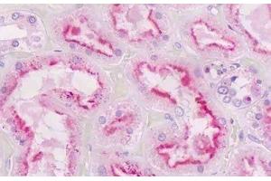 Human Kidney, Tubules: Formalin-Fixed, Paraffin-Embedded (FFPE) (GNAQ anticorps  (AA 52-78))