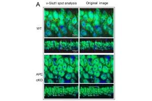 Representative images demonstrating vGlut1 (red) and NeuN (green) immunofluorescence staining in CA1 and cortex (CTX) of the mouse brain.