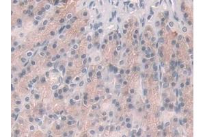 IHC-P analysis of Rat Stomach Tissue, with DAB staining. (Glucocorticoid Receptor anticorps  (AA 564-733))