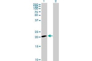 Western Blot analysis of CLDN20 expression in transfected 293T cell line by CLDN20 MaxPab polyclonal antibody.