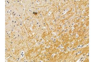 ABIN7094689 and ABIN7098740 at 1/100 staining rat brain tissue by IHC-P.