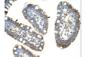 anti-DIS3-Like Exonuclease 2 (DIS3L2) (N-Term) antibody