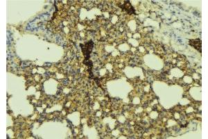 ABIN6277404 at 1/100 staining Mouse lung tissue by IHC-P. (ABCC1 anticorps  (N-Term))