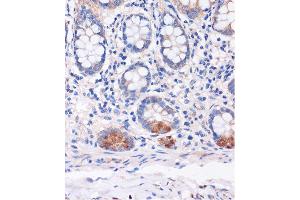 Immunohistochemistry of paraffin-embedded Human colon using SMYD3 Rabbit pAb (ABIN7270260) at dilution of 1:100 (40x lens). (SMYD3 anticorps  (AA 50-150))