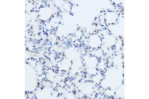 Immunohistochemistry of paraffin-embedded mouse lung using THRA Rabbit pAb (ABIN6128827, ABIN6149127, ABIN7101779 and ABIN7101780) at dilution of 1:50 (40x lens).