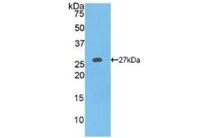 Detection of Recombinant COL1a1, Human using Polyclonal Antibody to Collagen Type I Alpha 1 (COL1a1)