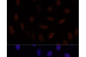 Immunofluorescence analysis of U-2 OS cells using GLI2 Polyclonal Antibody at dilution of 1:100. (GLI2 anticorps)