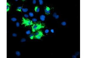 Image no. 1 for anti-Tripartite Motif Containing 9 (TRIM9) (AA 284-669) antibody (ABIN1491328)