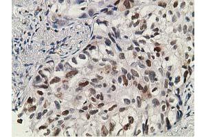 Image no. 4 for anti-Deoxycytidine Kinase (DCK) antibody (ABIN1497775)