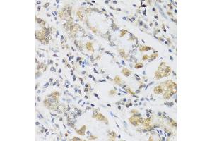 Immunohistochemistry of paraffin-embedded human stomach using RETN antibody (ABIN5974977) at dilution of 1/100 (40x lens). (Resistin anticorps)