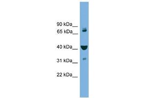 WB Suggested Anti-VPS16 Antibody Titration: 0. (VPS16 anticorps  (Middle Region))