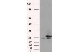 Image no. 3 for anti-Replication Protein A2, 32kDa (RPA2) antibody (ABIN1500739) (RPA2 anticorps)