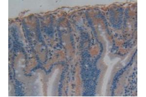 Figure. (tau anticorps  (AA 34-368))