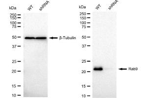 Western blotting analysis using Rab9 antibody (ABIN7800109). (Recombinant RAB9A anticorps)