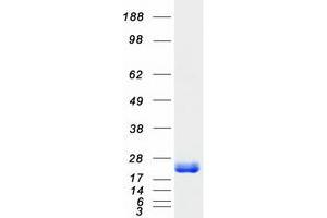 Validation with Western Blot