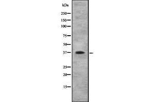 Western blot analysis IL10RB using COLO205 whole cell lysates (IL10RB anticorps  (C-Term))