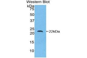 Western Blotting (WB) image for anti-Mesencephalic Astrocyte-Derived Neurotrophic Factor (MANF) (AA 28-182) antibody (ABIN1859738)