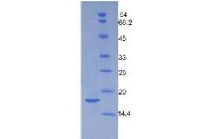 SDS-PAGE of Protein Standard from the Kit (Highly purified E. (Periostin Kit ELISA)