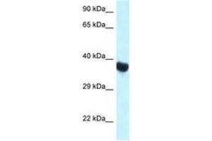 Image no. 1 for anti-Homeobox A10 (HOXA10) (C-Term) antibody (ABIN6747342) (HOXA10 anticorps  (C-Term))