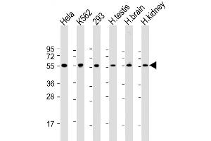 Western Blot at 1:2000 dilution Lane 1: Hela whole cell lysate Lane 2: K562 whole cell lysate Lane 3: 293 whole cell lysate Lane 4: human testis lysate Lane 5: human brain lysate Lane 6: human kidney lysate Lysates/proteins at 20 ug per lane. (PRAME anticorps  (C-Term))