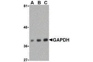Western Blotting (WB) image for anti-Glyceraldehyde-3-Phosphate Dehydrogenase (GAPDH) (C-Term) antibody (ABIN2473758) (GAPDH anticorps  (C-Term))
