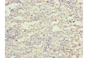 Immunohistochemistry of paraffin-embedded human spleen tissue using ABIN7152484 at dilution of 1:100 (FBXL5 anticorps  (AA 1-310))