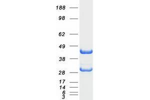 Validation with Western Blot