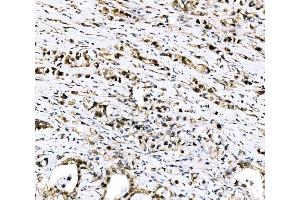 IHC analysis of RRS1 using anti-RRS1 antibody (ABIN7601344).